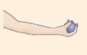 Diagrama de un brazo en flexión, ilustrando la acción del músculo flexor