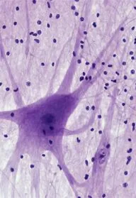 Cambios cerebrales durante la adolescencia